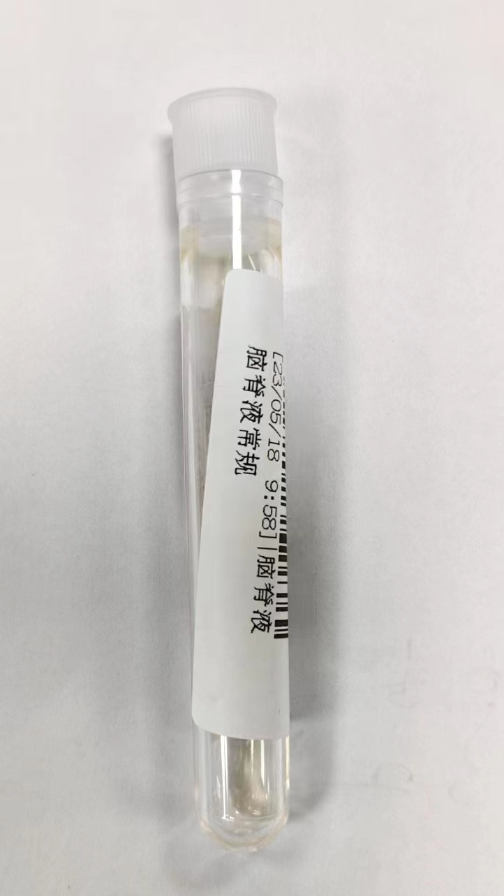 脑脊液常规检查(CSF)